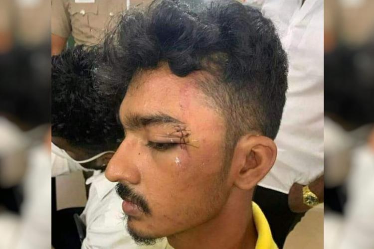 Law Students Humiliated and Brutally Assaulted by Chennai Police, Complaint Filed